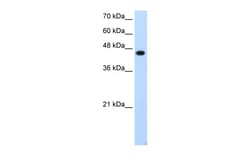 Aviva Systems Biology Corp TFAP2E Antibody - C-terminal region (ARP40023_T100)