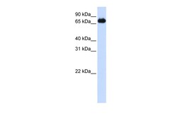 Aviva Systems Biology Corp FOXK2 Antibody - middle region (ARP40031_P050)