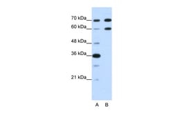 Aviva Systems Biology Corp DMRT2 Antibody - N-terminal region (ARP40046_T100)