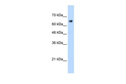 Aviva Systems Biology Corp ZNF326 Antibody - C-terminal region (ARP40068_T100)