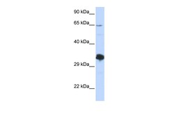 Aviva Systems Biology Corp ZNF630 Antibody - middle region (ARP40092_P050)