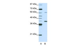 Aviva Systems Biology Corp MGC46336 Antibody - N-terminal region (ARP40116_P050)