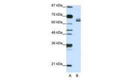 Aviva Systems Biology Corp ZFP57 Antibody - N-terminal region (ARP40121_T100)