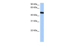 Aviva Systems Biology Corp TBX20 Antibody - middle region (ARP40123_P050)