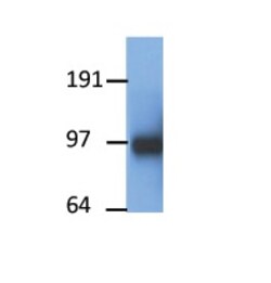 Aviva Systems Biology Corp Ppargc1a Antibody - middle region (ARP40129_P050)