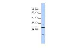 Aviva Systems Biology Corp INSIG2 Antibody - N-terminal region (ARP40165_P050)