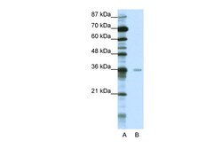 Aviva Systems Biology Corp MBD2 Antibody - middle region (ARP40169_T100)