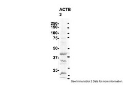 Aviva Systems Biology Corp ACTB Antibody - middle region (ARP40174_P050)