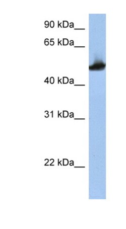 Aviva Systems Biology Corp TUBB2A Antibody - middle region (ARP40177_P050)
