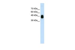 Aviva Systems Biology Corp HOMER1 Antibody - N-terminal region (ARP40182_P050)