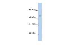 Aviva Systems Biology Corp PRMT8 Antibody - C-terminal region (ARP40193_T100)