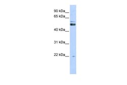 Aviva Systems Biology Corp PRMT2 Antibody - N-terminal region (ARP40195_P050)