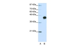 Aviva Systems Biology Corp KRT18 Antibody - N-terminal region (ARP40205_T100)
