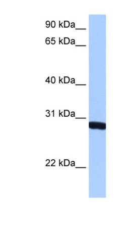 Aviva Systems Biology Corp SMN1 Antibody - N-terminal region (ARP40209_P050)