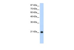 Aviva Systems Biology Corp RPL9 Antibody - C-terminal region (ARP40212_T100)