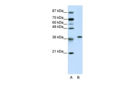 Aviva Systems Biology Corp RPL6 Antibody - N-terminal region (ARP40213_T100)