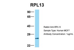 Aviva Systems Biology Corp RPL13 Antibody - C-terminal region (ARP40217_P050)