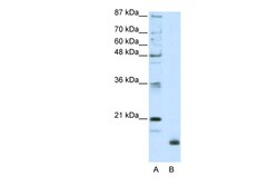 Aviva Systems Biology Corp RPL32 Antibody - N-terminal region (ARP40219_T100)