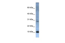 Aviva Systems Biology Corp ATP5MC2 Antibody - N-terminal region (ARP40228_P050)
