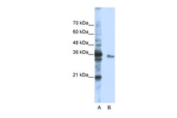 Aviva Systems Biology Corp EXOSC3 Antibody - middle region (ARP40231_P050)