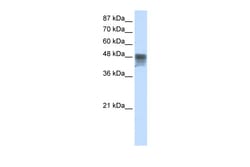 Aviva Systems Biology Corp RBMS3 Antibody - C-terminal region (ARP40235_T100)