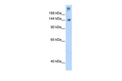 Aviva Systems Biology Corp SF3B1 Antibody - N-terminal region (ARP40249_T100)