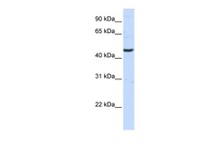 Aviva Systems Biology Corp KYAT3 Antibody - C-terminal region (ARP40266_P050)