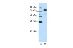 Aviva Systems Biology Corp FXR1 Antibody - C-terminal region (ARP40288_P050)