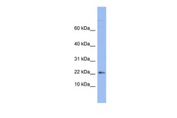 Aviva Systems Biology Corp RPS24 Antibody - middle region (ARP40304_P050)