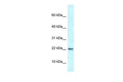 Aviva Systems Biology Corp Rbm3 Antibody - N-terminal region (ARP40307_P050)