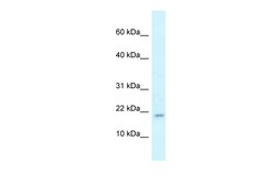 Aviva Systems Biology Corp Rbm3 Antibody - N-terminal region (ARP40309_P050)