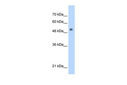 Aviva Systems Biology Corp SERBP1 Antibody - middle region (ARP40311_P050)