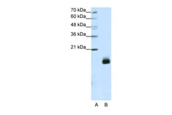 Aviva Systems Biology Corp RPS14 Antibody - N-terminal region (ARP40321_T100)