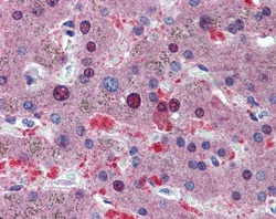 Aviva Systems Biology Corp CUGBP1 Antibody - middle region (ARP40327_P050)