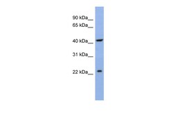 Aviva Systems Biology Corp SLC35F1 Antibody - N-terminal region (ARP40331_P050)
