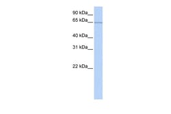 Aviva Systems Biology Corp PUM3 Antibody - middle region (ARP40334_P050)