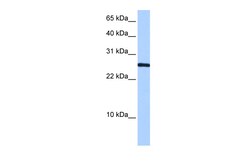 Aviva Systems Biology Corp CIRBP Antibody - N-terminal region (ARP40349_P050)