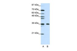 Aviva Systems Biology Corp FBL Antibody - N-terminal region (ARP40366_T100)
