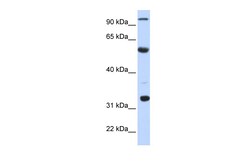 Aviva Systems Biology Corp APOBEC1 Antibody - N-terminal region (ARP40371_P050)