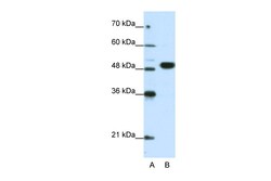 Aviva Systems Biology Corp EIF4A2 Antibody - N-terminal region (ARP40376_P050)