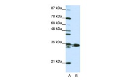 Aviva Systems Biology Corp HNRPA1 Antibody - N-terminal region (ARP40383_T100)
