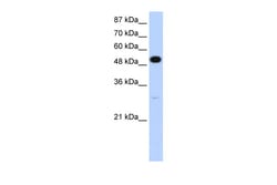 Aviva Systems Biology Corp NOVA2 Antibody - N-terminal region (ARP40399_T100)