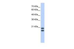Aviva Systems Biology Corp SRGN Antibody - middle region (ARP40416_P050)