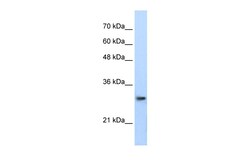 Aviva Systems Biology Corp PSMA1 Antibody - C-terminal region (ARP40417_P050)