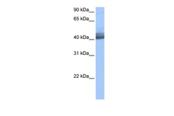 Aviva Systems Biology Corp RBM4 Antibody - middle region (ARP40426_P050)