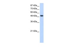 Aviva Systems Biology Corp RBMS1 Antibody - middle region (ARP40428_T100)