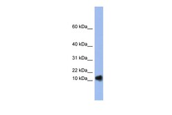 Aviva Systems Biology Corp RNASE1 Antibody - N-terminal region (ARP40433_P050)