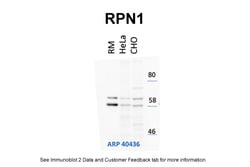 Aviva Systems Biology Corp RPN1 Antibody - N-terminal region (ARP40436_P050)