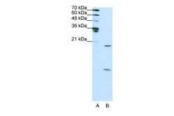 Aviva Systems Biology Corp SNRPF Antibody - N-terminal region (ARP40447_T100)