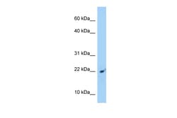 Aviva Systems Biology Corp SRP14 Antibody - C-terminal region (ARP40453_P050)